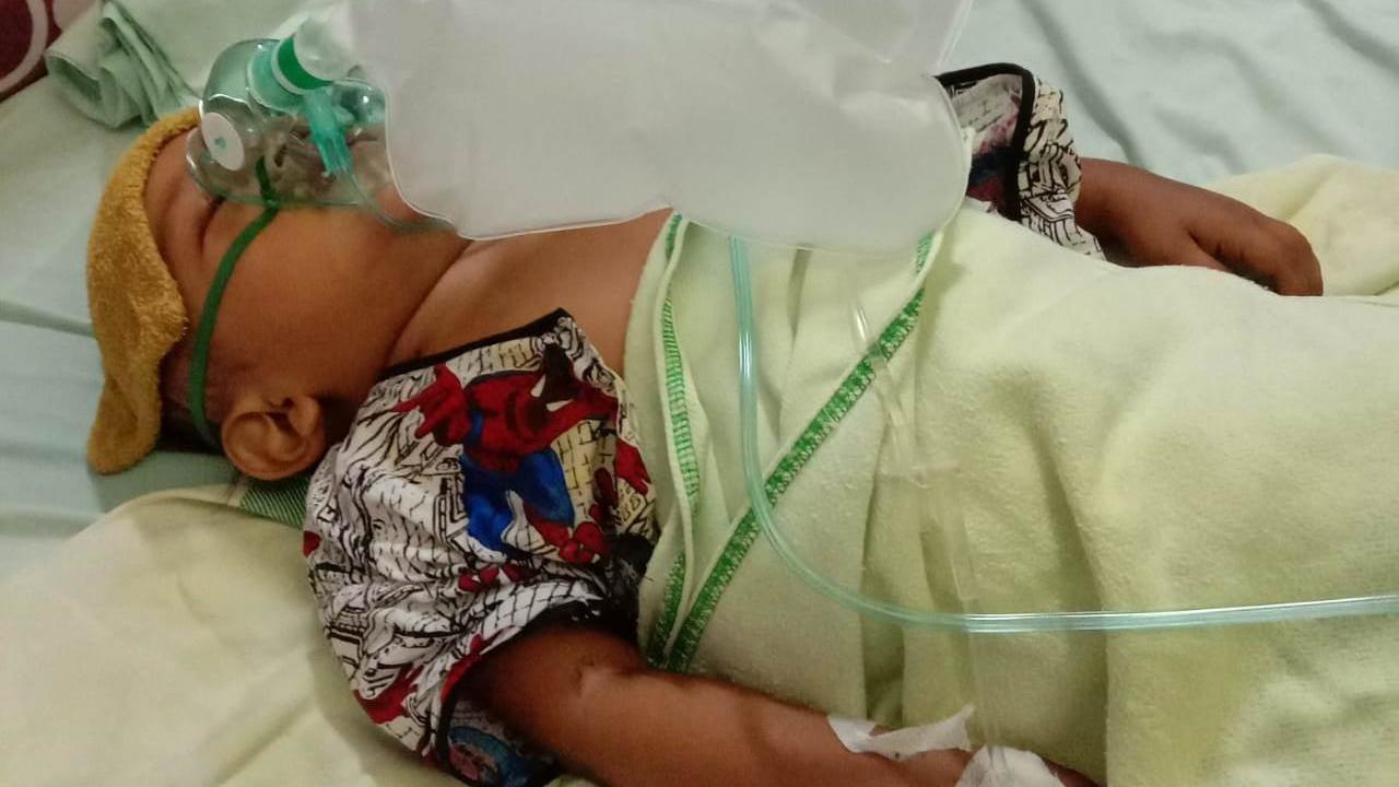 Balita 2 Tahun Penderita Kanker Tulang Asal Ogan Ilir Butuh Uluran Bantuan