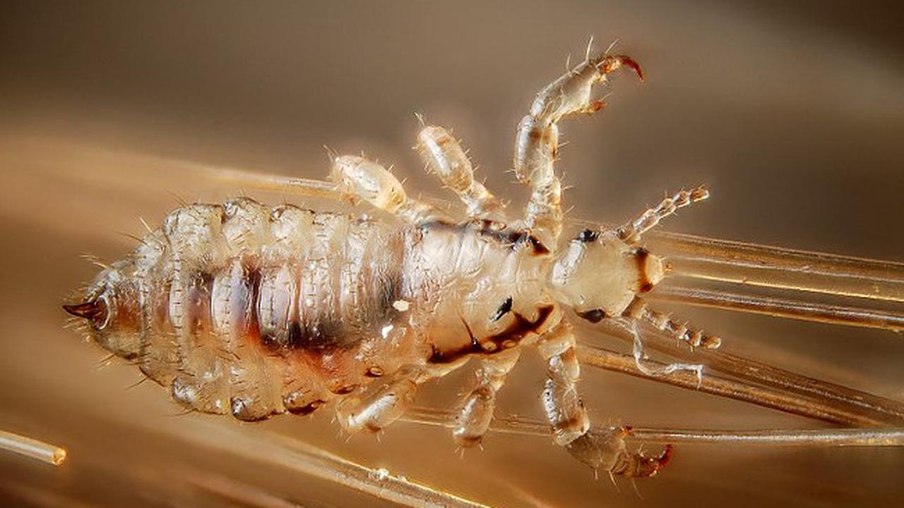 Karena Kutu Rambut, Wanita ini Sewa Tukang Pukul