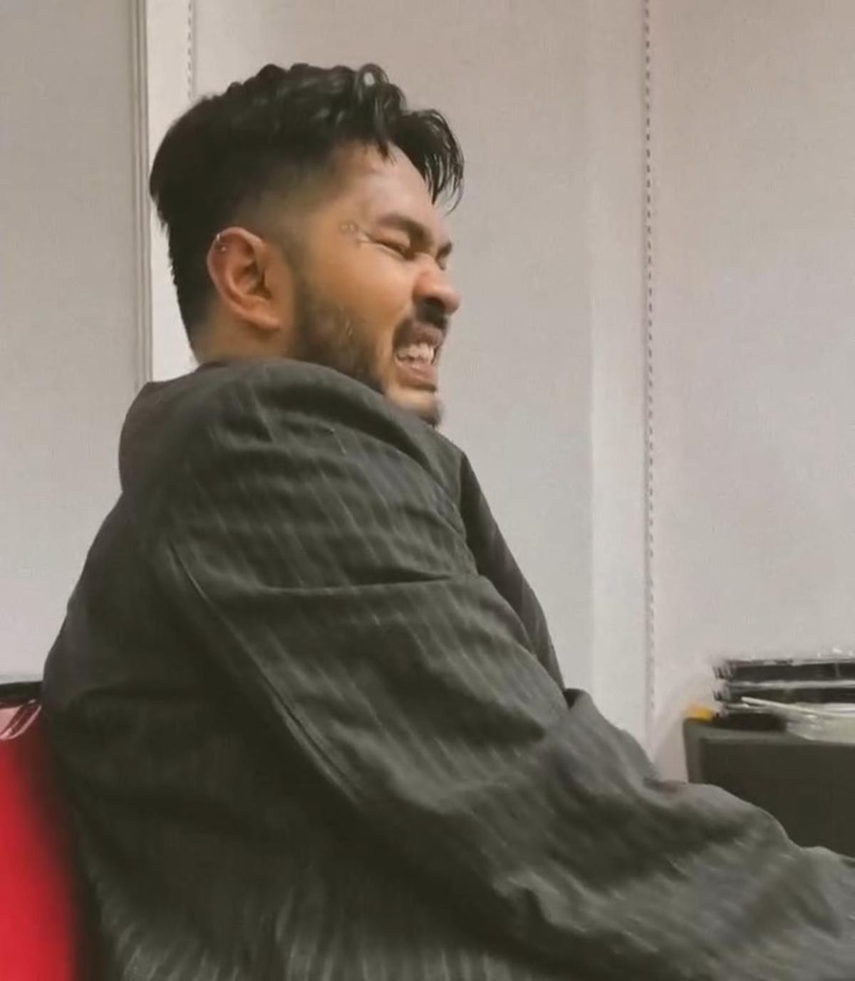 Onadio Leonardo Alami Insiden saat Manggung hingga Kakinya Diperban