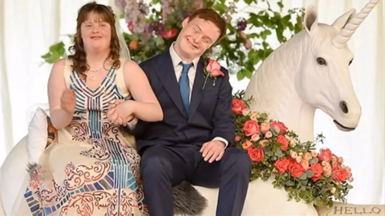 down syndrome