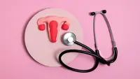 Dokter Ungkap Peluang Sembuh dari Kanker Endometrium