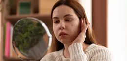 Kulit sensitif adalah kondisi di mana kulit lebih mudah bereaksi terhadap berbagai faktor. [Dok/freepik.com]