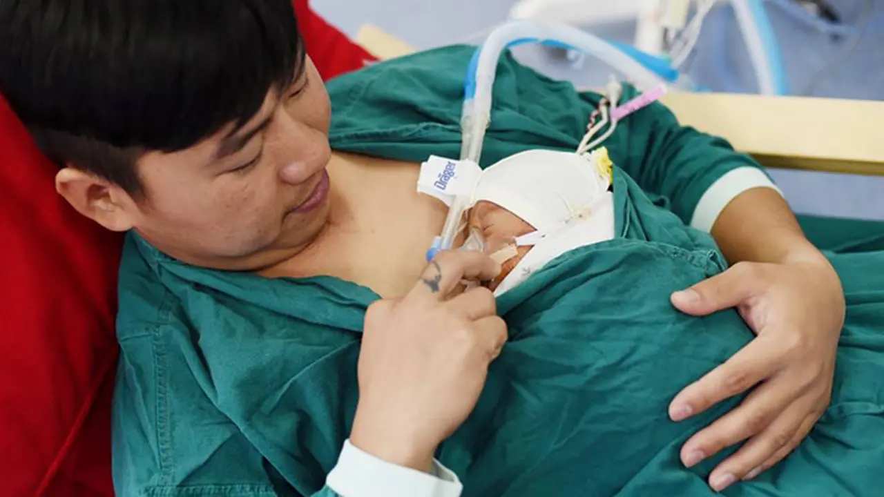 Teknik Baru `Perawatan Kangguru` untuk Tenangkan Bayi Prematur