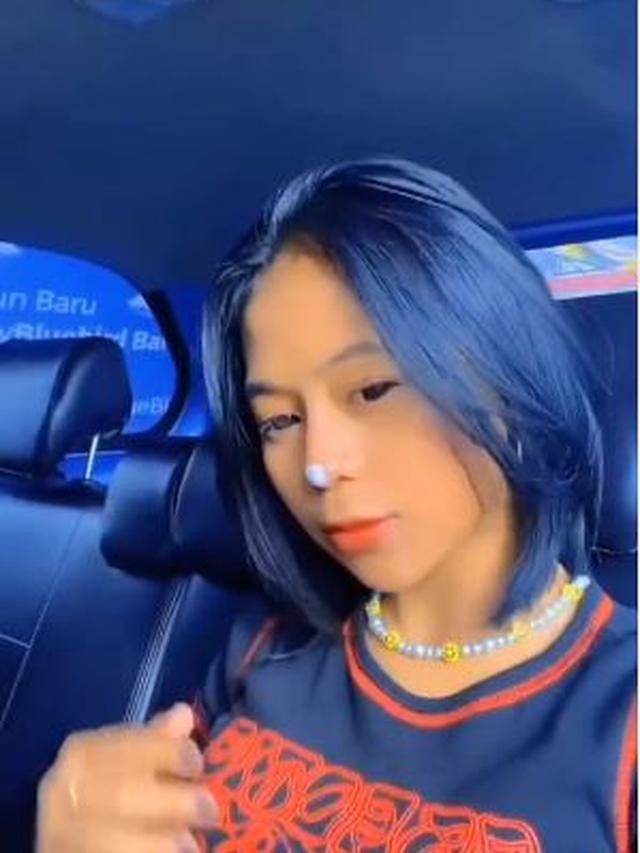 6 Potret Terbaru Cimoy Nuraini Usai Filler Hidung, Tampil Beda