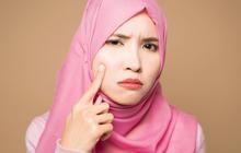 6 Buah yang Menyebabkan Jerawat, Perlu Diwaspadai