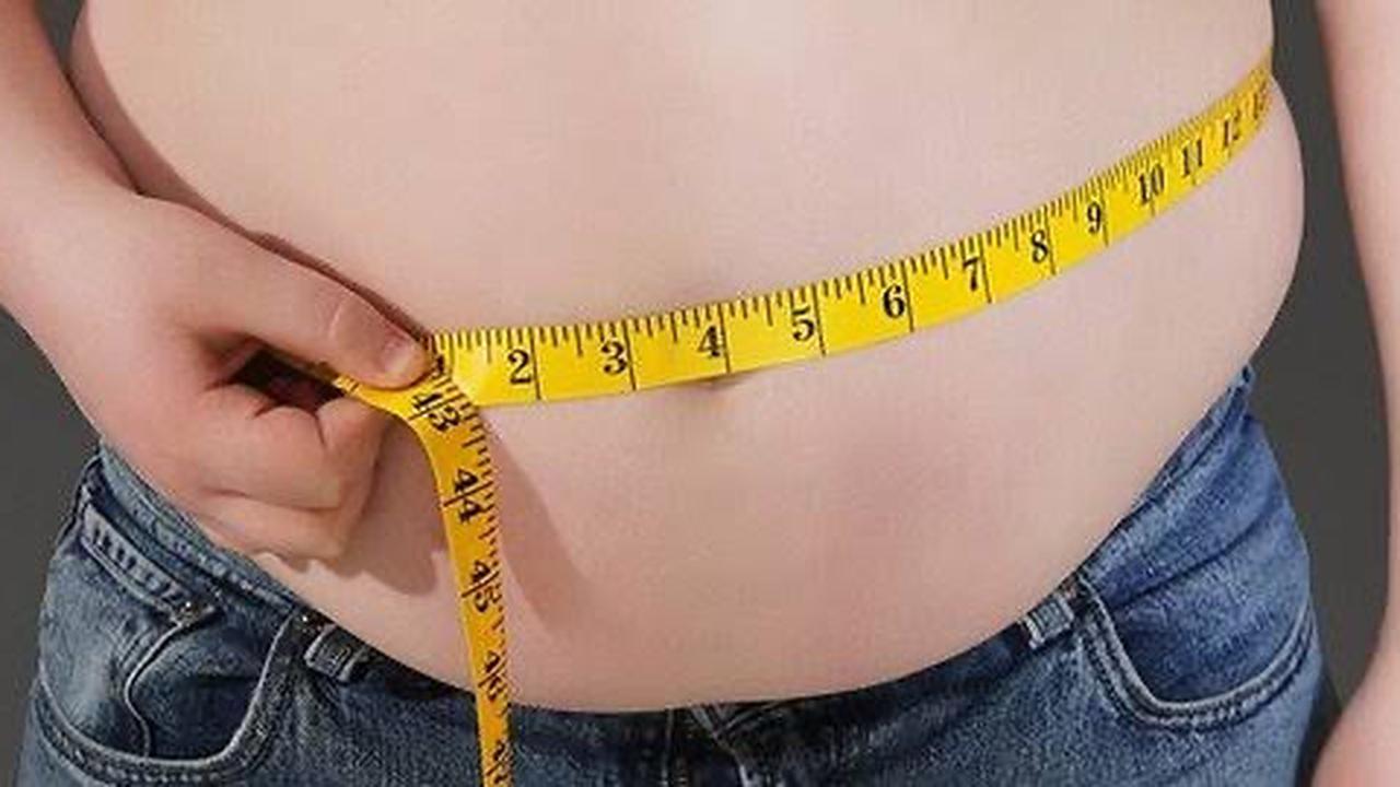 Deretan Kasus Obesitas Bikin Heboh di Indonesia, Ada yang Sampai Meninggal