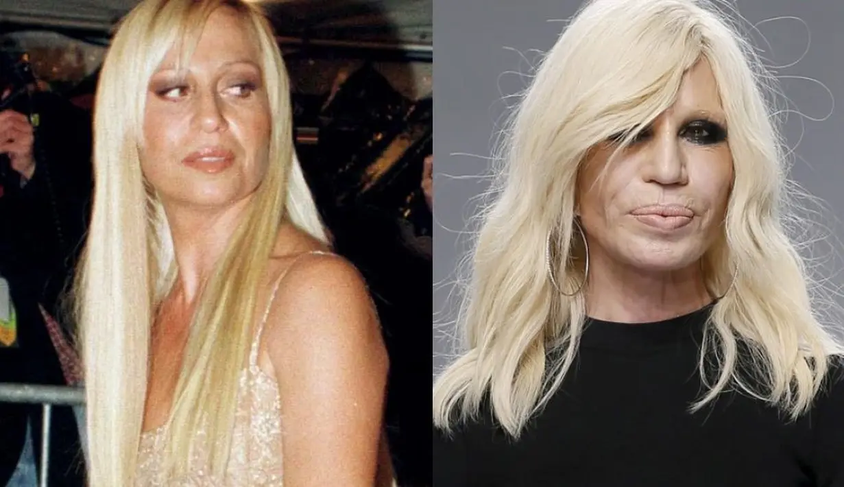Terlihat jelas Donatella Versace melakukan serangkaian operasi plastik. Coba deh kamu nggak sengaja ketemu dia di jalan yang gelap. Hmmmm... (FoxNews)