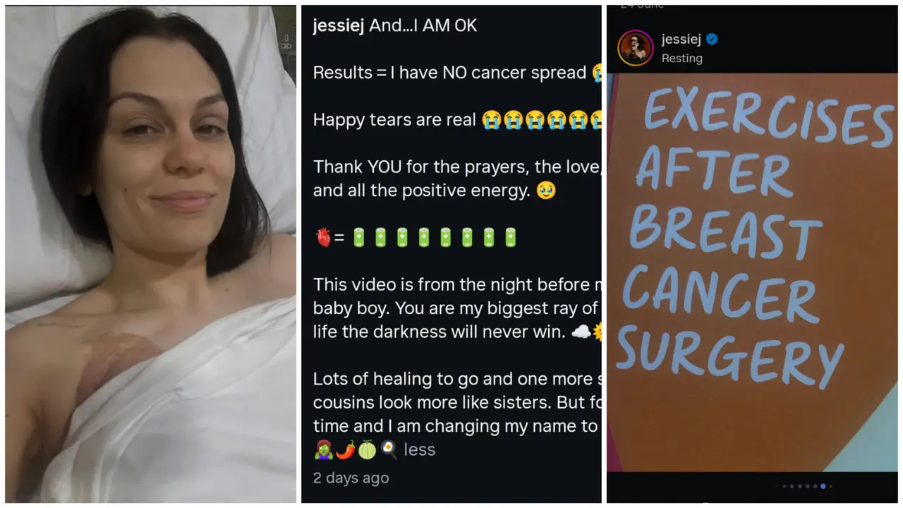 Kabar Terbaru Jessie J Usai Operasi Kanker Payudara: I AM OK