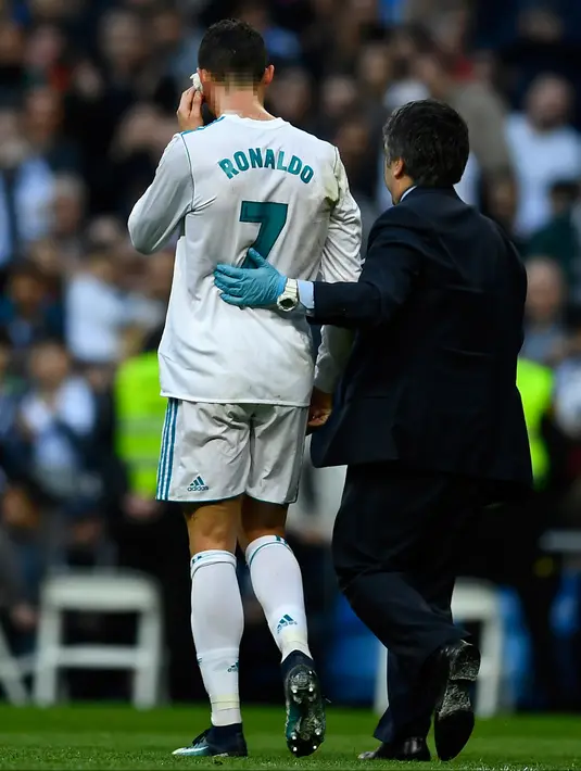 Penyerang Real Madrid, Cristiano Ronaldo memegang kepalanya yang berdarah setelah bek Deportivo de la Coruna, Fabian Schaer menendang kepalanya saat bertanding di La Liga Spanyol di Santiago Bernabeu, Madrid (21/1). (AFP Photo/Oscaro Del Pozo)