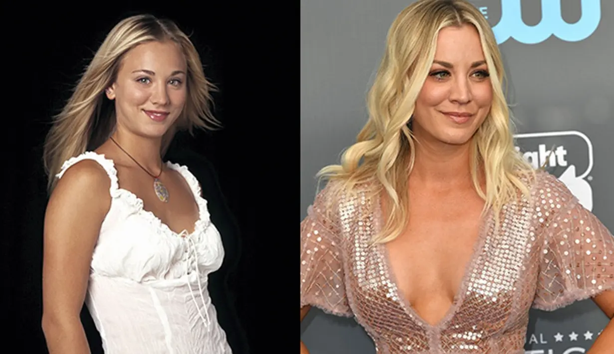 Kaley Cuoco engaku dirinya melakukan operasi plastik untuk hidungnya, memperbesar payudara dan fillers. (Rex/Shutterstock/HollywoodLife)