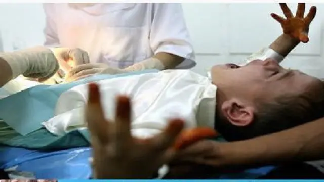 Sembunyikan Rasa Takut, 6 Ekspresi Anak Disunat Ini Bikin Ngakak