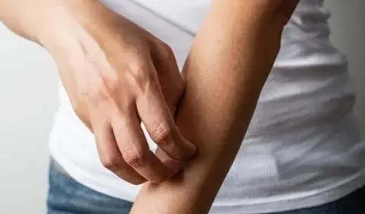 Luka Hampir Sembuh