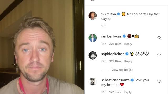 Tom Felton Ungkap Kabar Terkini Usai Kolaps Di Lapangan Golf Showbiz Liputan6 Com