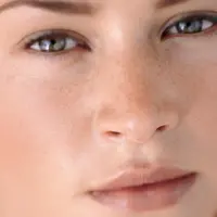 Ilustrasi kulit wajah kusam. (Purewow.com)