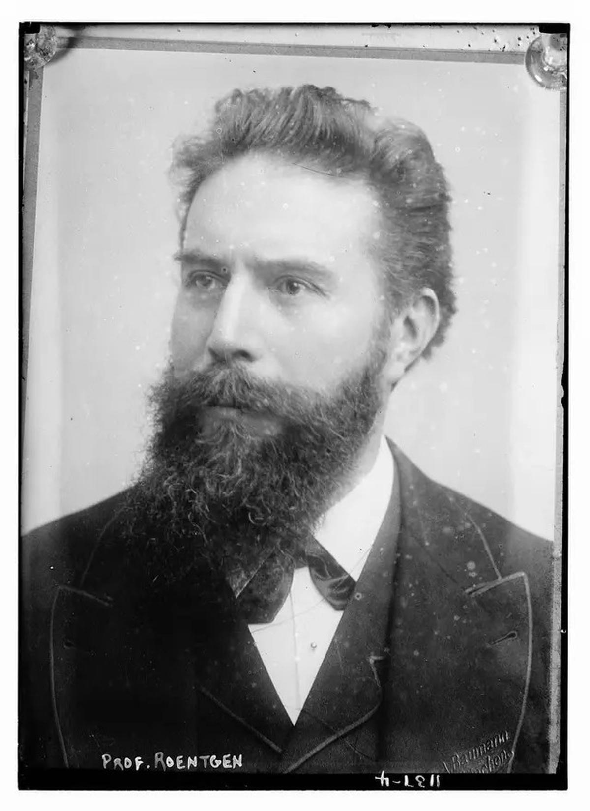8 November 1895: Wilhelm Roentgen Menemukan X-Ray