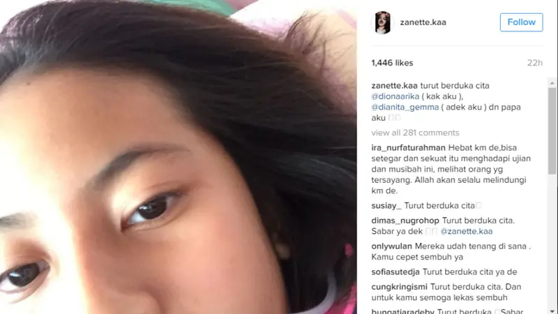 Selamat dari Pembunuhan Pulomas, Zanette Unggah Foto ke Instagram