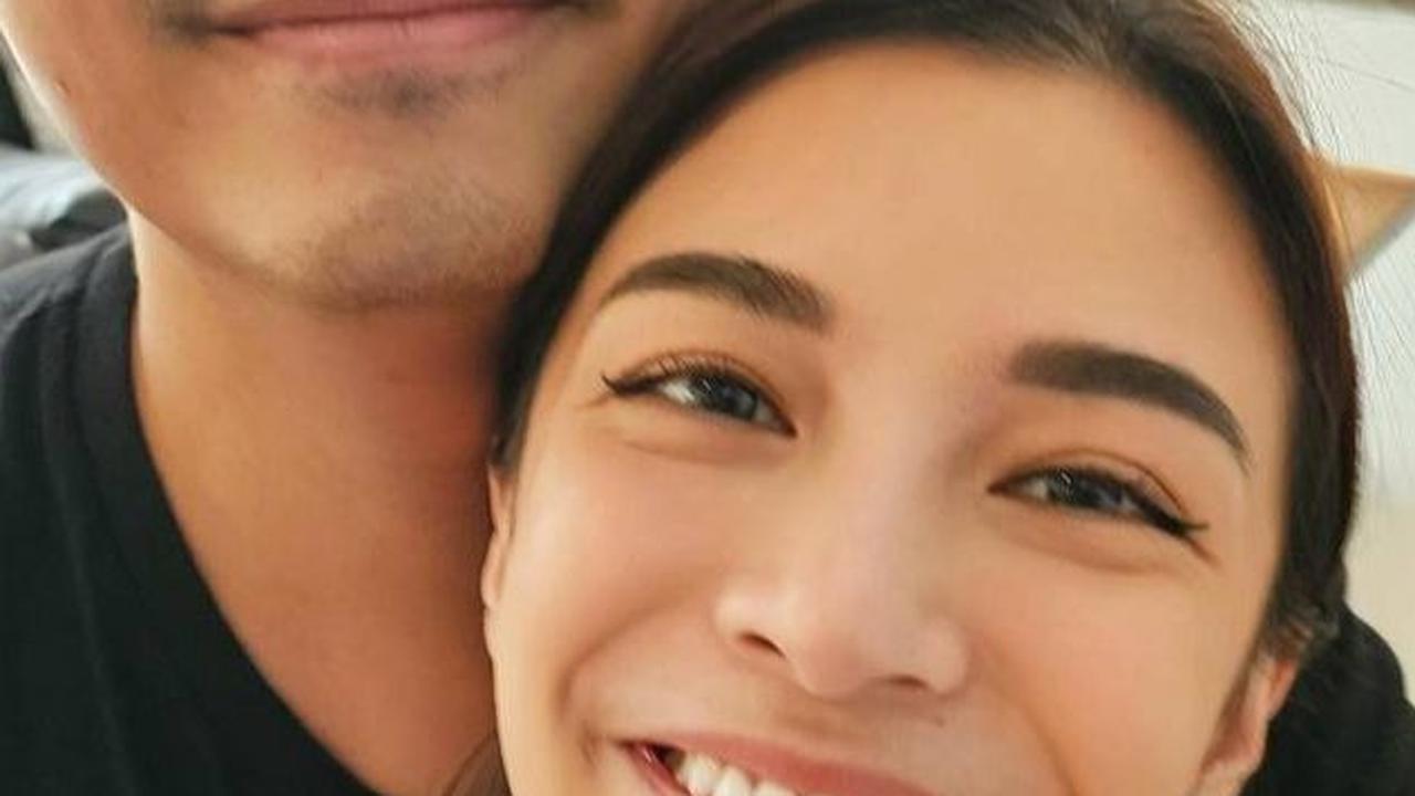 Potret Terbaru Chelsea Olivia, Perawatan Gigi Gingsulnya Makin Rapi