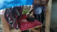 Asep Tahyar (55 ) pria setengah baya waefa Dusun Sukamaju  Rt 02/09 Desa Cikampek Timur, Kecamatan Cikampek, Karawang, akhirnya dievakuasi untuk pemeriksaan medis di RS Helsa Cikampek. (Liputan6.com/Abramena)