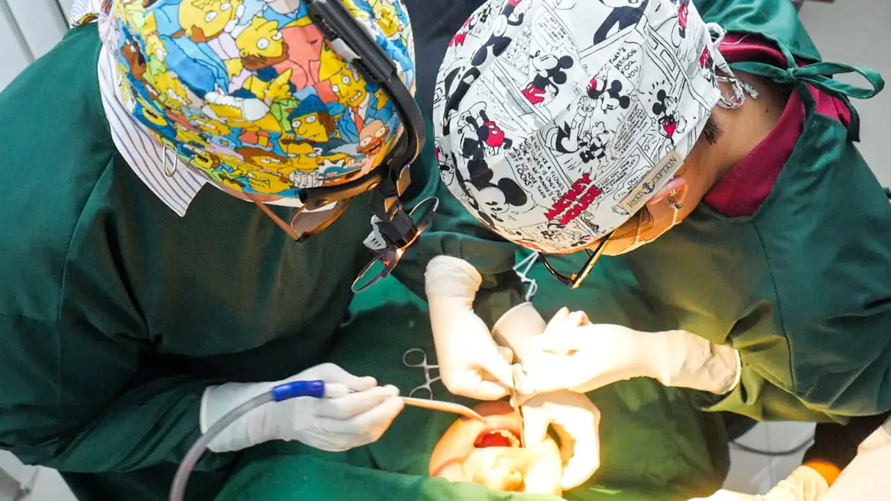 buccal fat removal