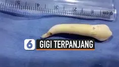 vertical gigi