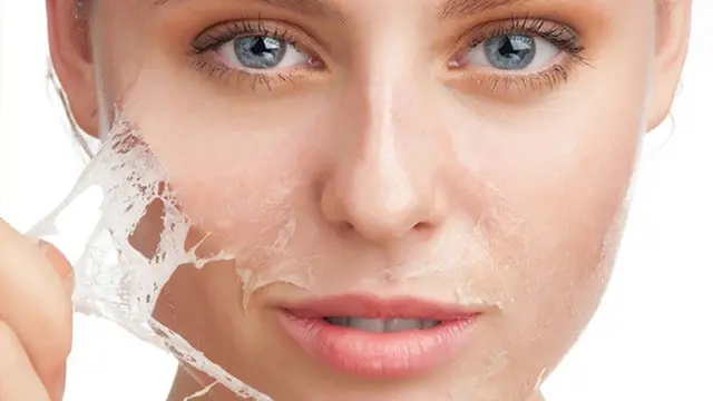 ilustrasi eksfoliasi kulit/pexels