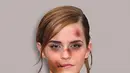 Aktris Emma Watson ditampilkan dengan wajah lebam seperti habis dipukul. Foto yang diedit itu pun diberi tulisan yang memotivasi wanita untuk melawan tindak kekerasan. (dailymail.co.uk)