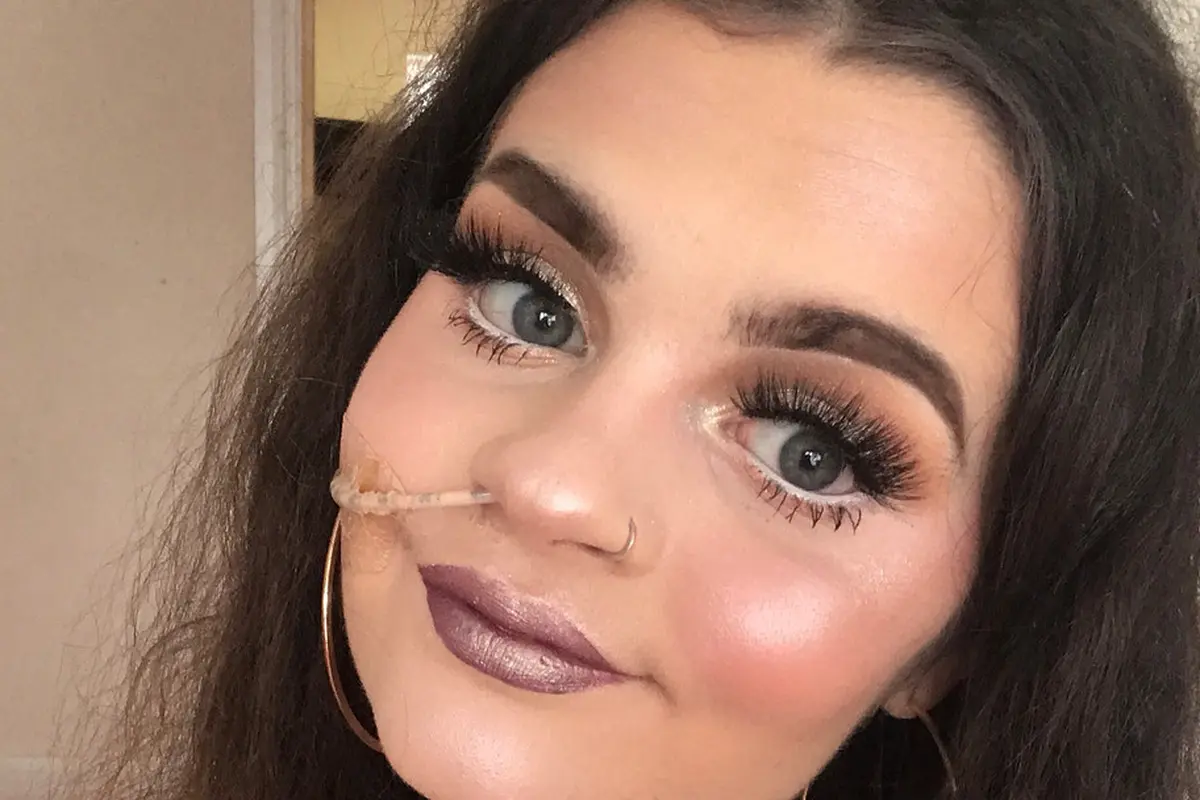 [Fimela] Kisah beauty vlogger yang harus menggunakan selang makanan seumur hidup
