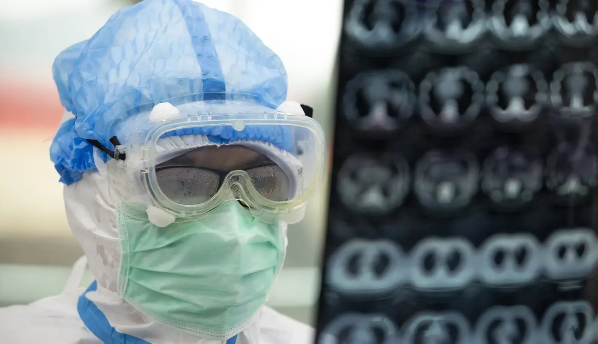 Dokter Zheng Wanli memeriksa citra tomografi terkomputasi (computed tomography/CT) milik pasien di sebuah rumah sakit sementara di Distrik Jiangxia, Wuhan, Provinsi Hubei, China tengah, (25/2/2020). (Xinhua/Shen Bohan)