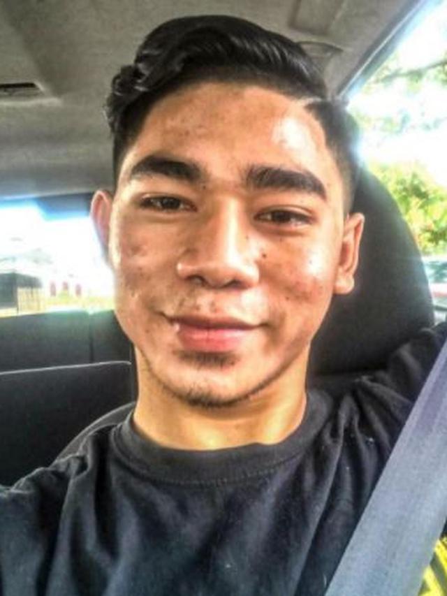 Dulu Dibully Wajah Seperti Jalanan Rusak, Perubahan Pria Ini Bikin Kagum