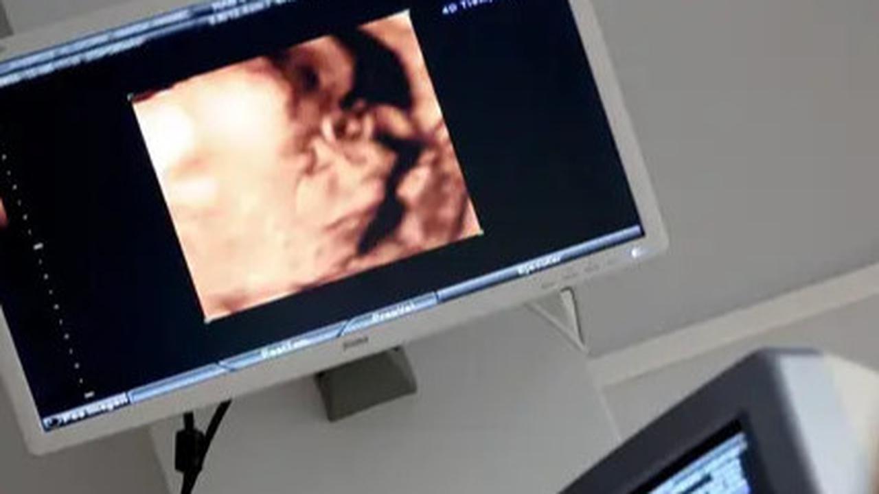 Kepala Bayinya Tak Terlihat saat Periksa USG, Kisah Calon Ibu Ini Bikin Haru