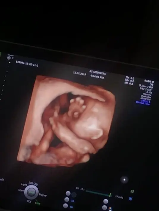 (Instagram/aurakasih)