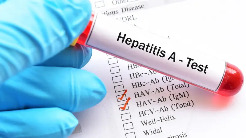 Penyebab Hepatitis