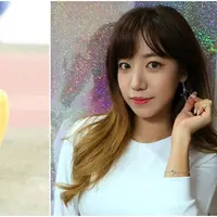 Namjoo Apink rela lakukan operasi plastik demi promosi Apink?