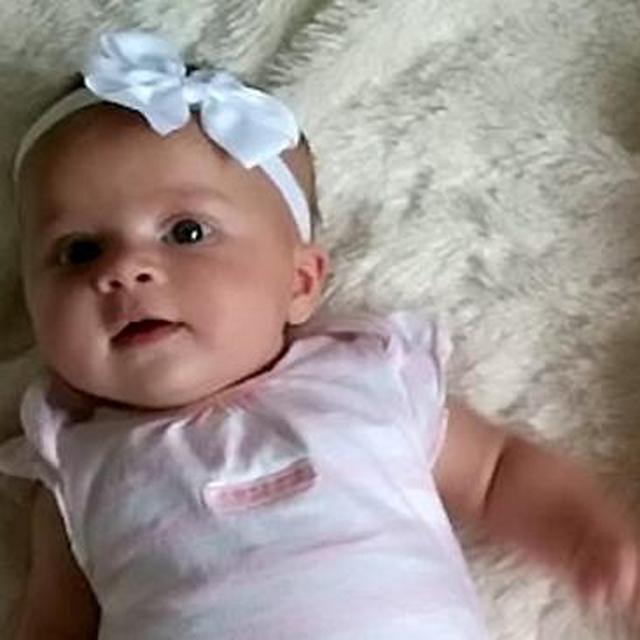 Langka Bayi Kembar Ini Terlahir Beda Warna Kulit Global Liputan6 Com