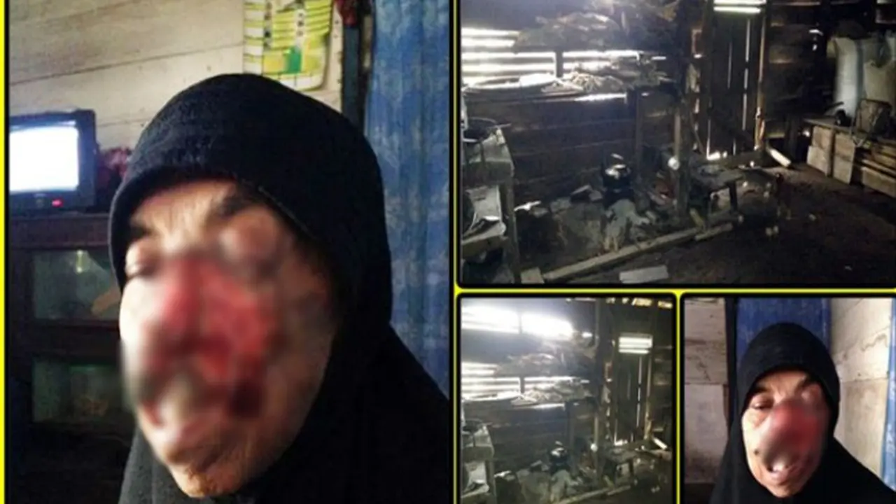 Uluran Tangan Untuk Bantu Nenek Ratma Penderita Kanker Kulit