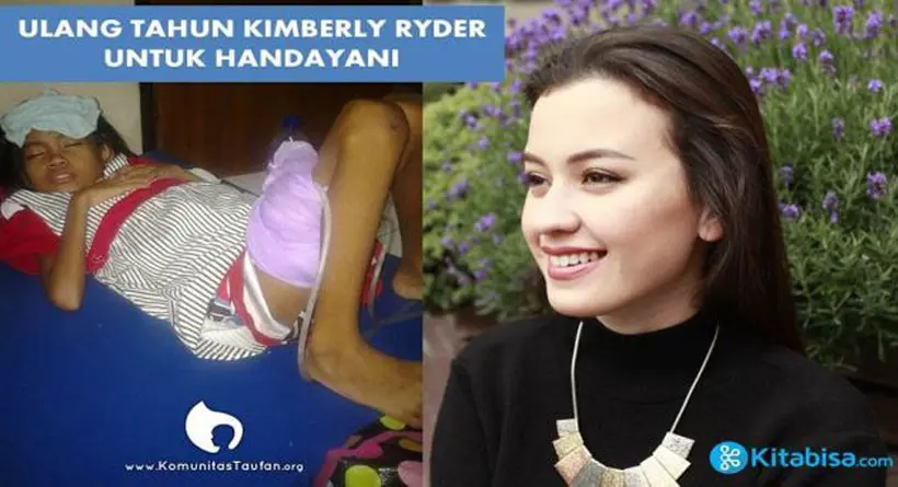 Kimberly Ryder mengajak masyarakat dan netizen beramal untuk kesembuhan Handayani, pasien penderita tumor abdomen. (istimewa)