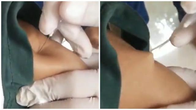 Viral Kakek Kulitnya Tak Tembus Jarum Suntik saat Divaksin, Bikin Geleng Kepala