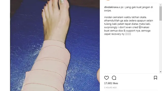 Dinda Kirana (Foto: Instagram)