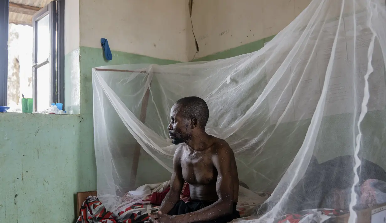 Pengiriman pertama hampir 100 ribu dosis vaksin mpox, akan tiba di Republik Demokratik Kongo pada Kamis, kata badan pengawas kesehatan Uni Afrika. (AP Photo/Moses Sawasawa)