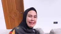 Wajah Kartika Putri melepuh dan lebam parah. Luka lebam menjalar ke lidah dan langit-langit mulut. Kini, ia berobat ke Singapura dan berharap lekas sembuh. (Foto: Dok. Instagram @kartikaputriworld)