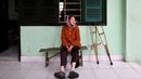 Penderita kusta Nguyen Thi Teo duduk di luar kamarnya yang berada di kompleks RS Van Mon Leprosy, Thai Binh, Vietnam, Kamis (10/1). Saat ini hanya tersisa 190 pasien di rumah sakit khusus kusta tertua di Vietnam tersebut. (Manan Vatsyayana/AFP)