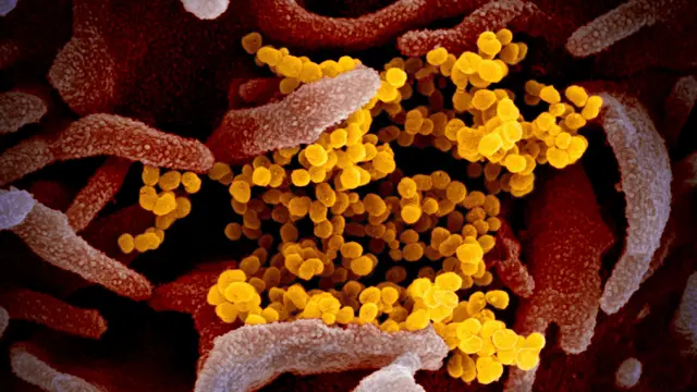 Gambar menggunakan mikroskop elektron yang tak bertanggal pada Februari 2020 menunjukkan virus corona SARS-CoV-2 (kuning) muncul dari permukaan sel (merah muda) yang dikultur di laboratorium.  Sampel virus dan sel diambil dari seorang pasien yang terinfeksi COVID-19. (NIAID-RML via AP)