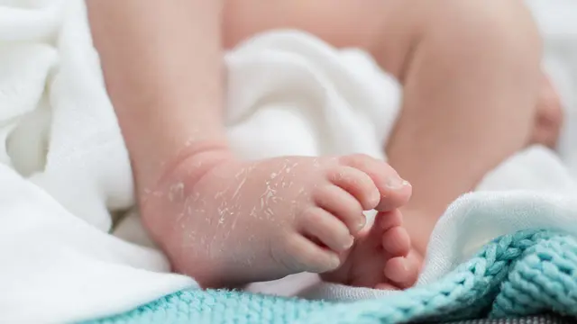 Penyakit Kulit pada Bayi