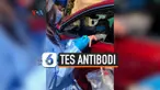 tes antibodi
