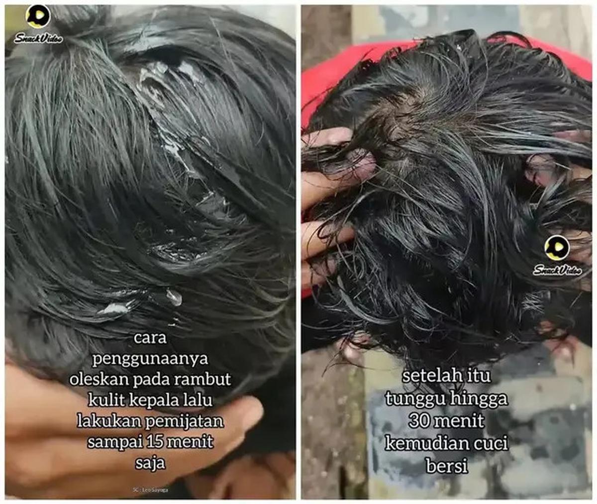 Cara Menumbuhkan Rambut Rontok Secara Alami, Cukup Gunakan 2 Bahan