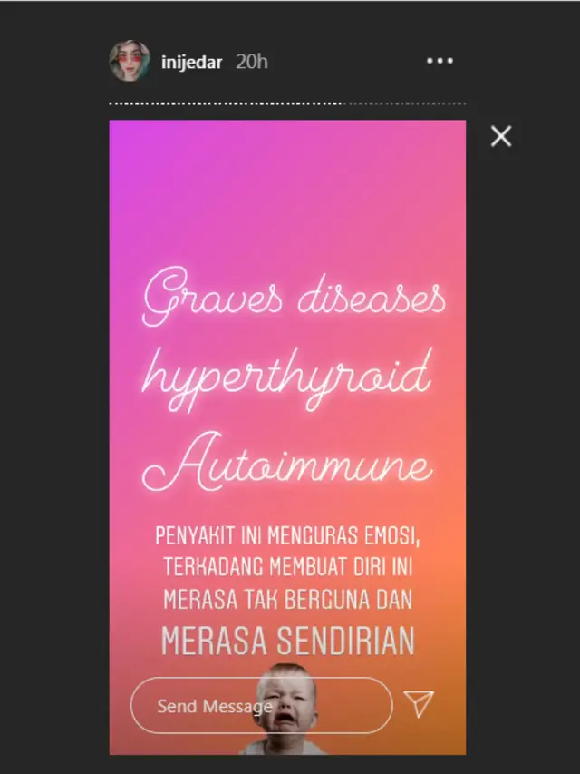 Jessica Iskandar merasa hidupnya tak berguna karena idap autoimun