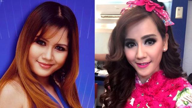 Artis Artis Ini Ngaku Lakukan Operasi Plastik Showbiz Liputan6 Com