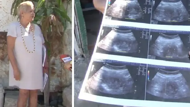 Dikabarkan Hamil, Wanita 70 Tahun Asal Meksiko Bisa Memegang Gelar Ibu Tertua di Dunia