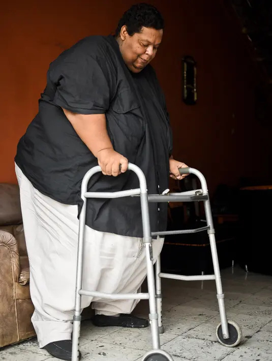 Oscar Vasquez Morales (44) berjalan di rumahnya di Palmira, Kolombia, 19 Maret 2016. Oscar mengatakan masalah berat badannya itu dipicu oleh depresi dan mencari pelampiasan ke junk food dan pola hidup yang tidak sehat. (AFP PHOTO/Luis ROBAYO)