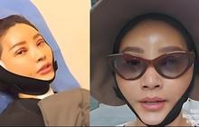 Sarwendah Mengunggah Foto Wajahnya Setelah Operasi Plastik di Korea, Netizen Membandingkan Dengan Bunda Inul